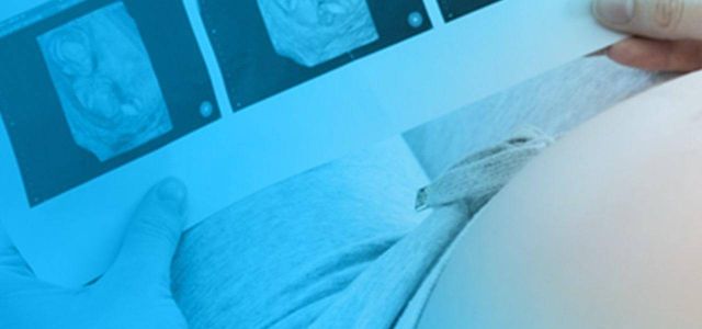 HiPo Ärztevermittlung Gynäkologie