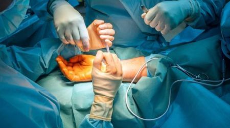 Zwei Ärzte mit Zusatzbezeichnung operieren den Arm eines Patienten