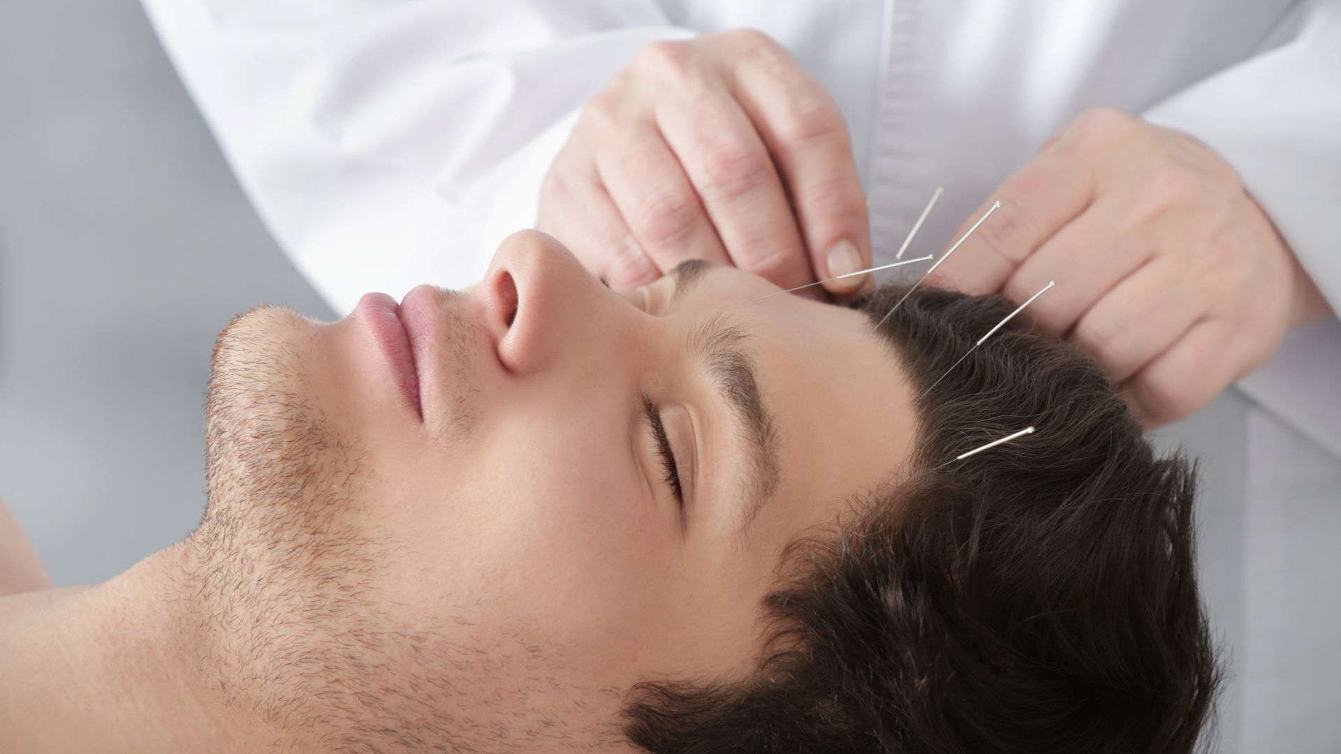 Hausarzt behandelt einen Patienten mittels Akupunktur